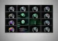brain in green of medical monitor display Illustration