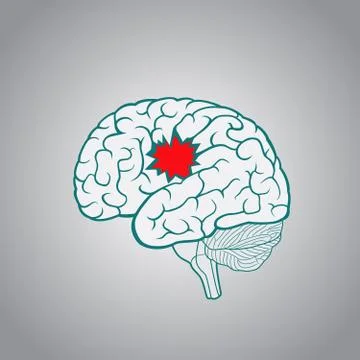A brain with a hole, the concept of destruction of the brain, memory, stroke Illustrazione stock