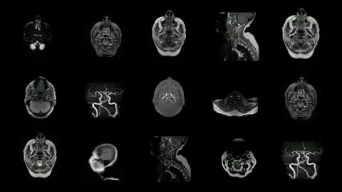 Brain imaging mri scan concept health future technology human research illness 動画素材 336569343