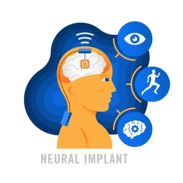 Brain implants. Neural implants. Flat vector illustration Stock Illustration