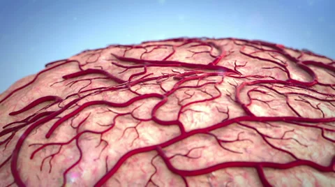 Brain, insult Video stock 45038595