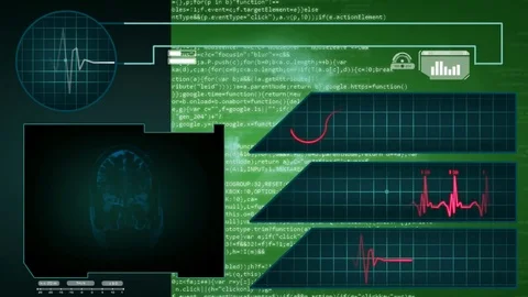 Brain - Interface - medical screen - graphics - green Stock Footage