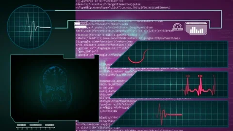 Brain - Interface - medical screen - graphics - purple Stock Footage