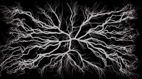 Brain links, branching like tree roots in our thoughts. Stock Footage 304488713