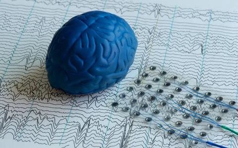 Brain model and subdural electrode for invasive EEG Stock Photos