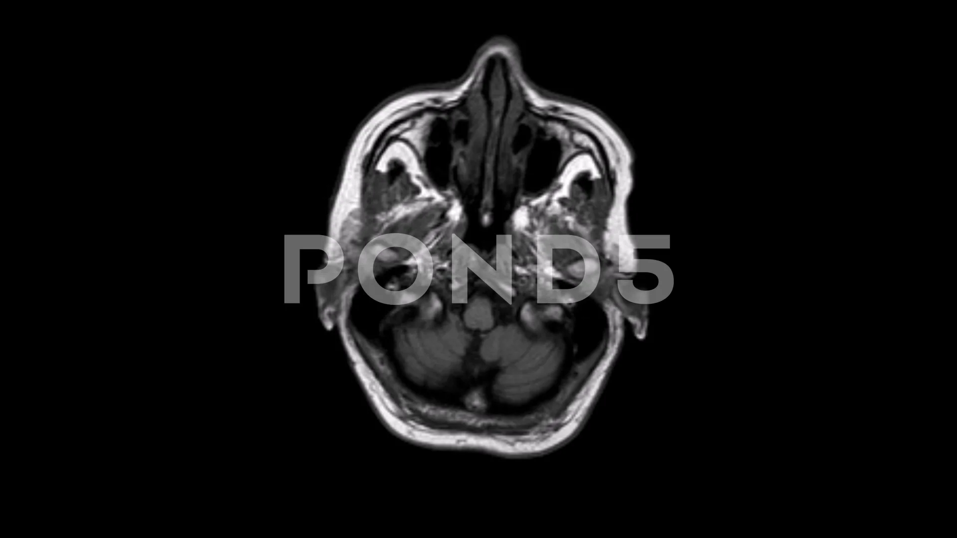 axial head mri scan