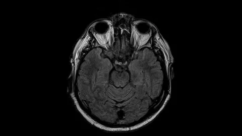 Brain MRI, head scans and tumor detection. Diagnostic medical tool Stock-Footage 121288693