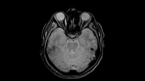 Brain MRI, head scans and tumor detection. Diagnostic medical tool Stock-Footage 121524921