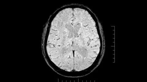 Brain MRI, head scans and tumor detection. Diagnostic medical tool Stock Footage 259131727