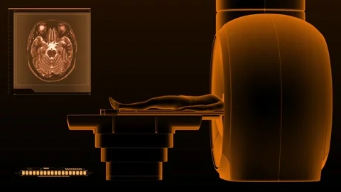 Brain MRI imaging orange Stock Footage 245807641