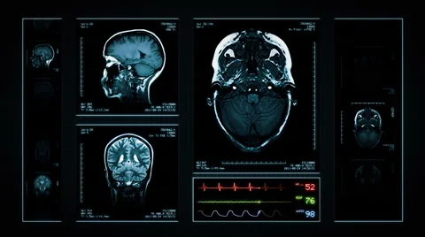 Brain MRI Scan. Blue. 3 in 1. Video stock 54837099
