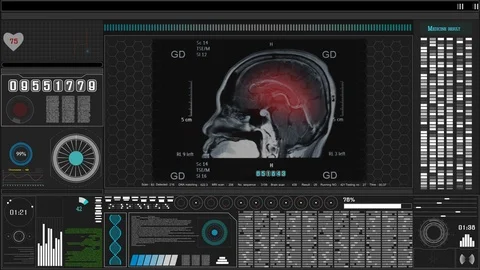 Brain MRI scan Stock Footage 103189067