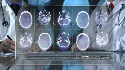 Brain Mri Scan Stock Footage 200160466