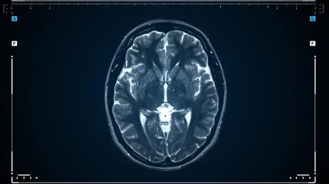 Brain MRI scan. Scanning of brain's magnetic resonance image. Diagnostic Medical Stock Illustration