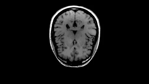 Brain MRI  scan visualisation animation. Stock Footage 236924103