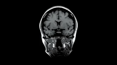 Brain MRI  scan visualisation animation. Stock Footage 236924113