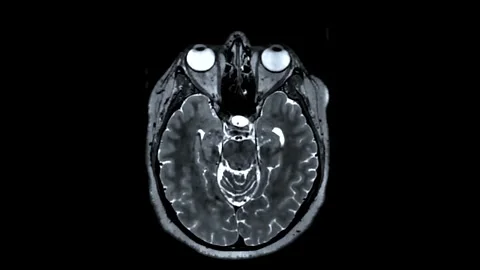 Brain MRI  scan visualisation animation. Stock Footage 236924114