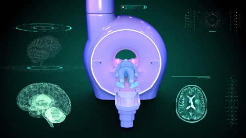 Brain MRI SCANNER front Stock Footage 245481696