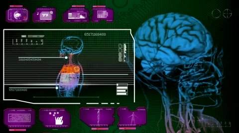 Brain - Multi Interface Scan - pink 01 Stock Footage 59516901