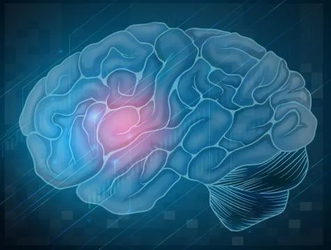 Brain with pain Stockillustratie