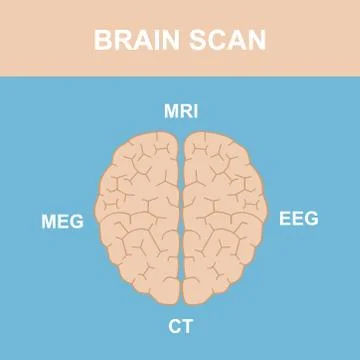 Brain Scan 1 Stock Illustration