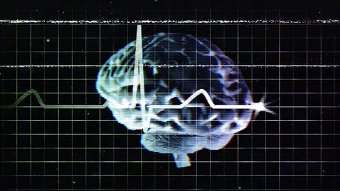Brain Scan with Electric Wave on Retro TV with Glitch Effect, Vj Loop Stock Footage 105087803