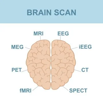 Brain Scan Stock Illustration