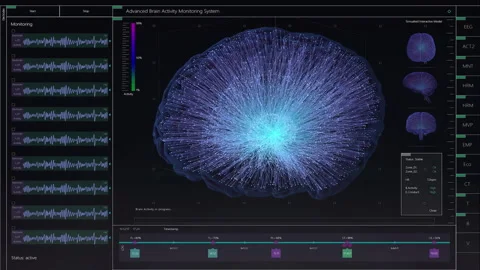 Brain Scan Mockup | Stock Video | Pond5