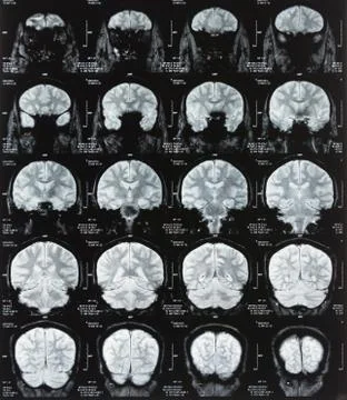 Brain scan Stock Photos