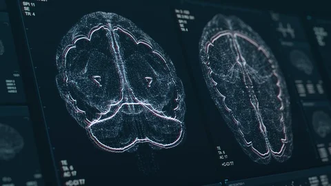 Brain scan screen animation. The device scans and displays vital signs Stock-Footage 124093255