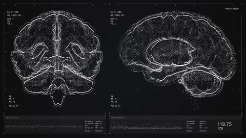 Brain scan screen animation. The device ... | Stock Video | Pond5