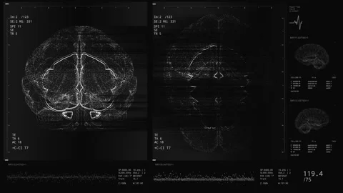 Brain scan screen animation. The device ... | Stock Video | Pond5