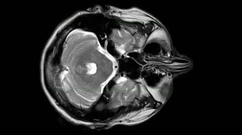 Brain Scan Top View Stock Footage 688988