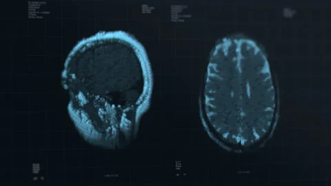 Brain scan visualization animation. Diagnosis data on laboratory display Stockbeeldmateriaal 158538546