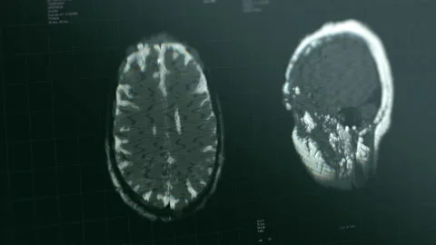 Brain scan visualization animation. Diagnosis data on laboratory display Stock Footage 158538726