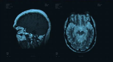Brain scan visualization animation. Diagnosis data on laboratory display Stock Footage 158538751