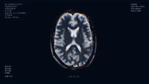 Brain scan visualization clip. Diagnosis data. Hospital screen. Human research Stockbeeldmateriaal 130903860