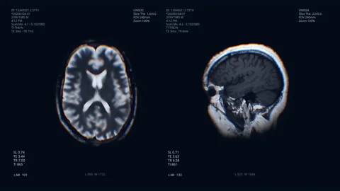 Brain scan visualization. Diagnosis data on hospital screen. Medical equipment Stockbeeldmateriaal 130904117