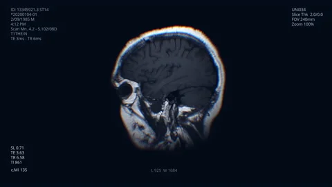 Brain scan X-ray visualization.Human illness research. Head diagnosis, MRI, CT Stockbeeldmateriaal 130904053