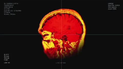 Brain scanning animation. X-ray. Neurology test. MRI CT Stockbeeldmateriaal 131757925