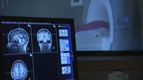 Brain scans on computer screen from an MRI Stock Footage