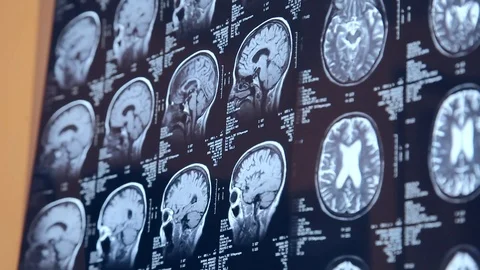 Brain Scans MRI CT Vidéo 114513694
