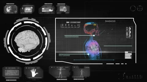 Brain - Screen Virus Detector - grey 01 Stock Footage 59642871