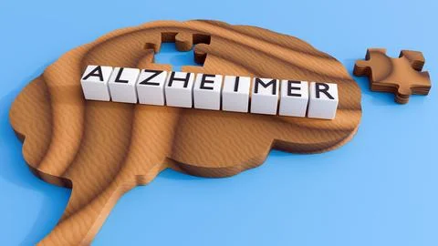 A brain-shaped puzzle with a missing piece and the word ALZHEIMER on cubes. Stock Illustration