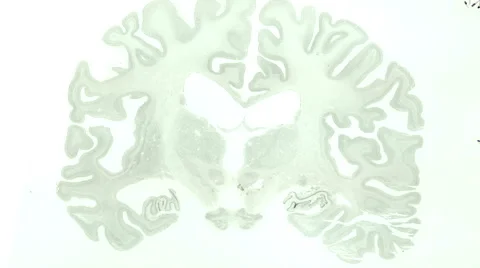 Brain Slice Stock Footage 59609817