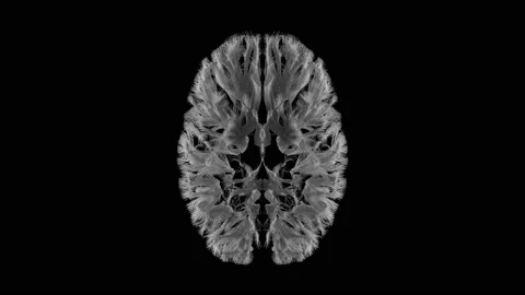 Brain slices sequence, mapping grey matter and white matter in 3d, 4k Top view Stock Footage