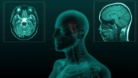 Brain stem MRI Stock Footage 253497417