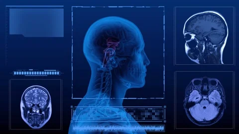 Brain stem MRI multi Stock Footage 255717449