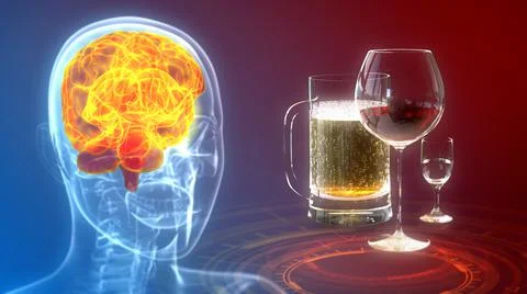 Brain stricken by beer and alcohol, cg medical 3d illustration Stock Illustration