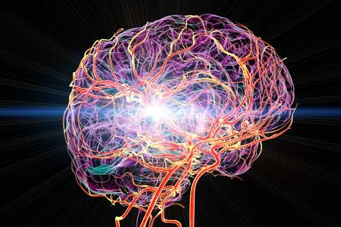 Brain stroke, conceptual 3D illustration Stock Illustration